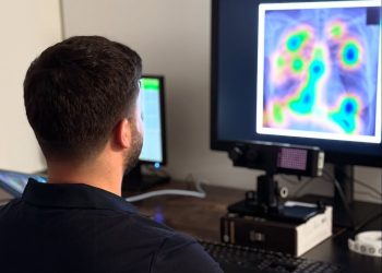 Radyologlara Yardımcı Yapay Zeka: GazeVal