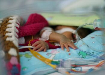 Prematüre Bebekleri Koruyan Proje: 28 Dikiş Projesi